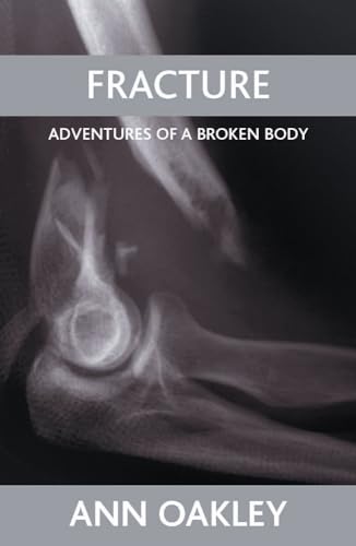 Fracture: Adventures of a Broken Body von Policy Press